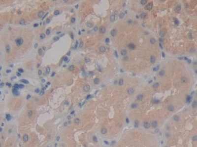 Polyclonal Antibody to Aminopeptidase B (RNPEP)