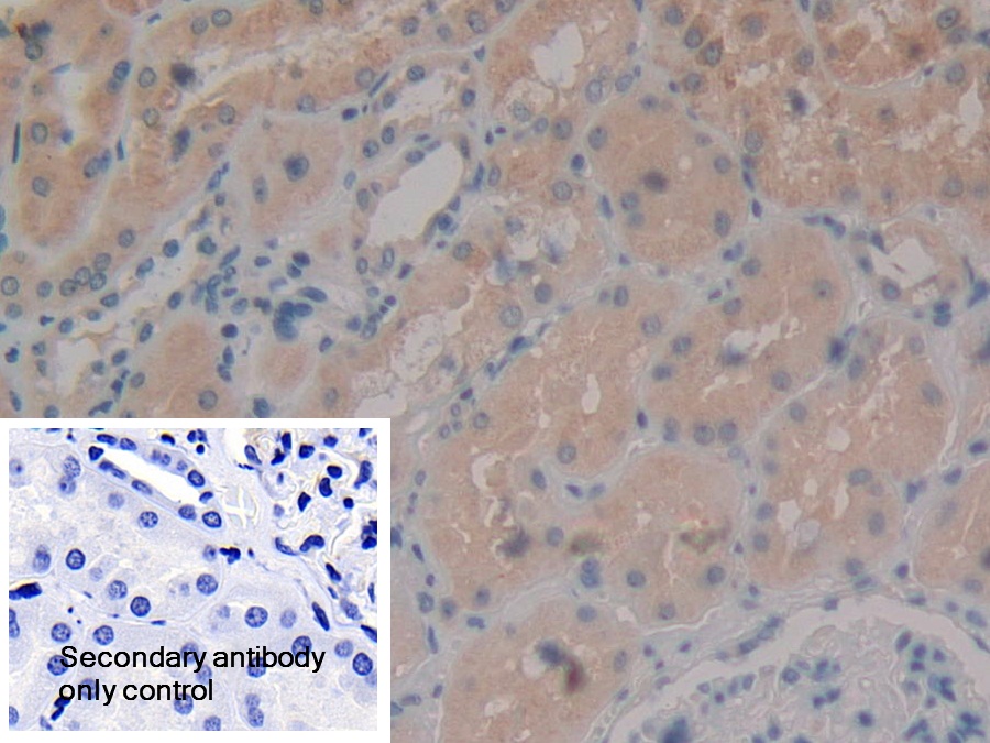 Polyclonal Antibody to Aminopeptidase B (RNPEP)