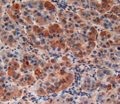 Polyclonal Antibody to Relaxin/Insulin Like Family Peptide Receptor 1 (RXFP1)