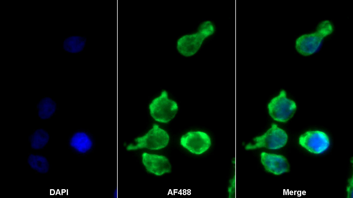 Polyclonal Antibody to Relaxin/Insulin Like Family Peptide Receptor 1 (RXFP1)