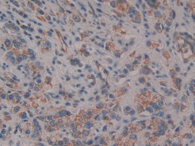 Polyclonal Antibody to Cluster Of Differentiation 109 (CD109)