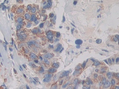 Polyclonal Antibody to MAP Kinase Activated Protein Kinase 2 (MAPKAPK2)