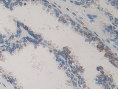 Polyclonal Antibody to MAP Kinase Activated Protein Kinase 2 (MAPKAPK2)