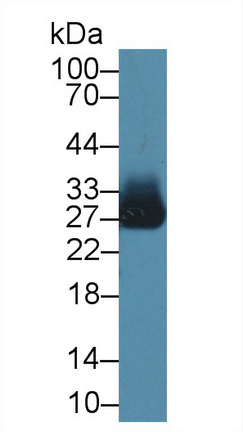 Polyclonal Antibody to Azurocidin (AZU)