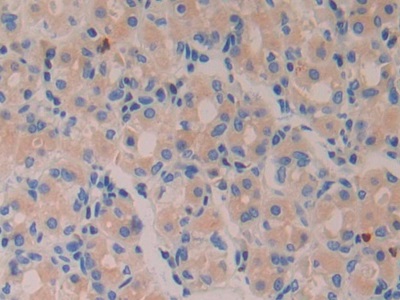 Polyclonal Antibody to Azurocidin (AZU)