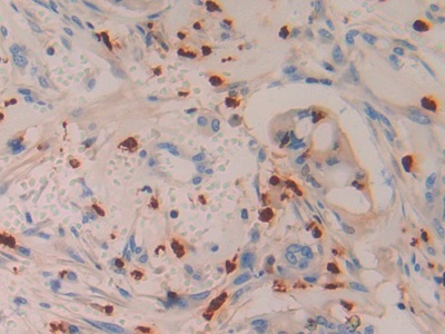 Polyclonal Antibody to Azurocidin (AZU)