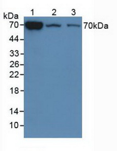 Polyclonal Antibody to Chitinase-3-like Protein 1 (CHI3L1)