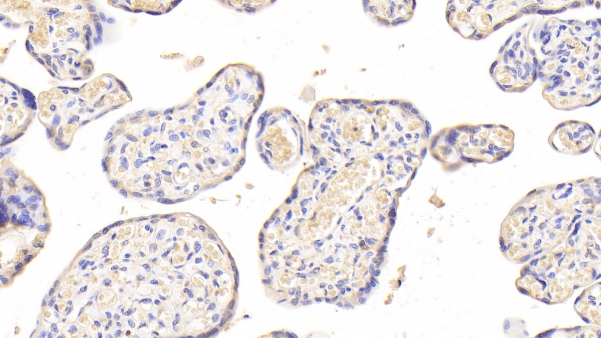 Polyclonal Antibody to Lysosomal Associated Membrane Protein 2 (LAMP2)