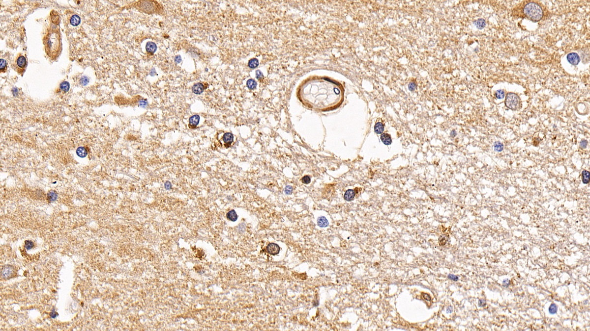 Polyclonal Antibody to Lysosomal Associated Membrane Protein 2 (LAMP2)