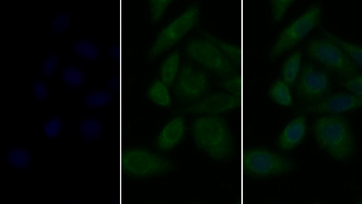 Polyclonal Antibody to Lysosomal Associated Membrane Protein 2 (LAMP2)