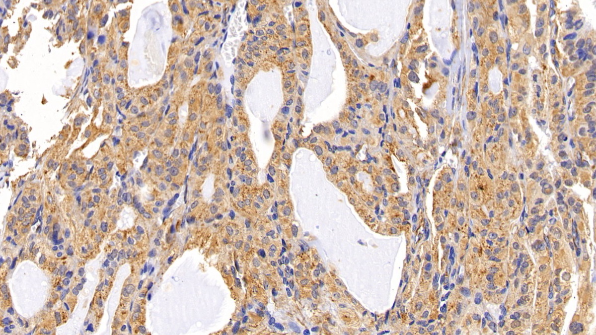 Polyclonal Antibody to Lysosomal Associated Membrane Protein 2 (LAMP2)