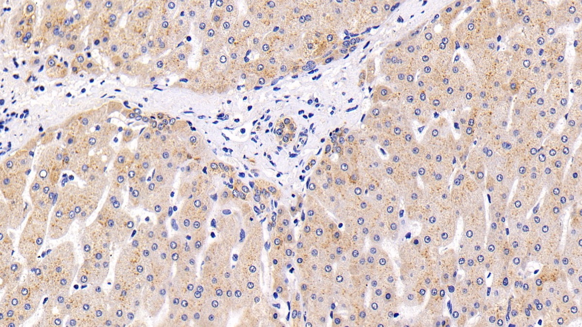 Polyclonal Antibody to Lysosomal Associated Membrane Protein 2 (LAMP2)