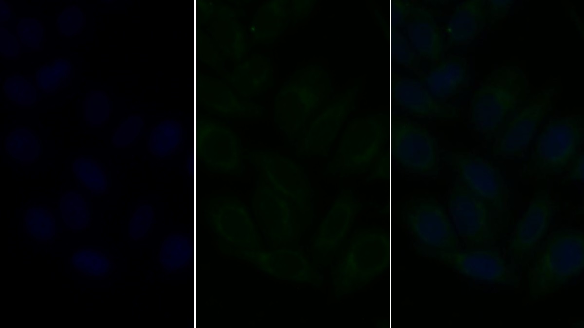 Polyclonal Antibody to Lysosomal Associated Membrane Protein 2 (LAMP2)