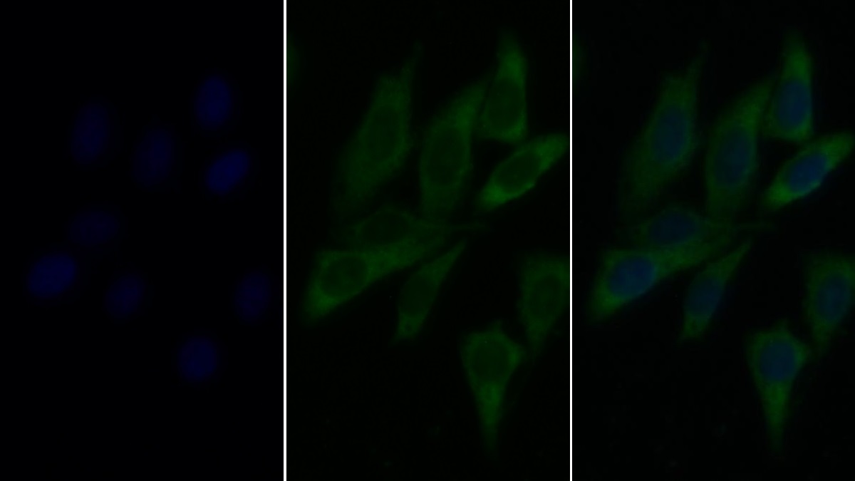 Polyclonal Antibody to Lysosomal Associated Membrane Protein 2 (LAMP2)