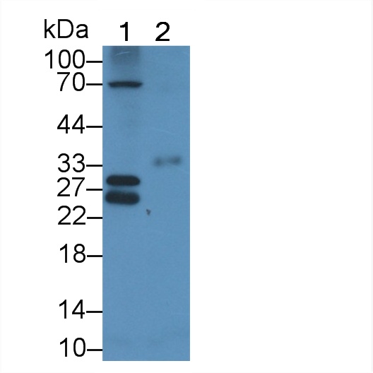 Polyclonal Antibody to Connexin 31 (CX31)