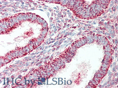 Polyclonal Antibody to Alkaline Phosphatase (ALP)