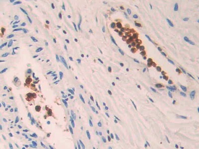 Polyclonal Antibody to Pitrilysin Metalloproteinase 1 (MP1)