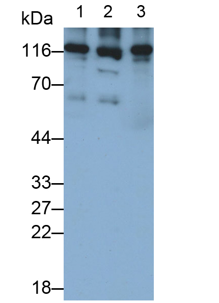 Polyclonal Antibody to Pitrilysin Metalloproteinase 1 (MP1)