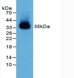 Polyclonal Antibody to Nectin 2 (NECTIN2)