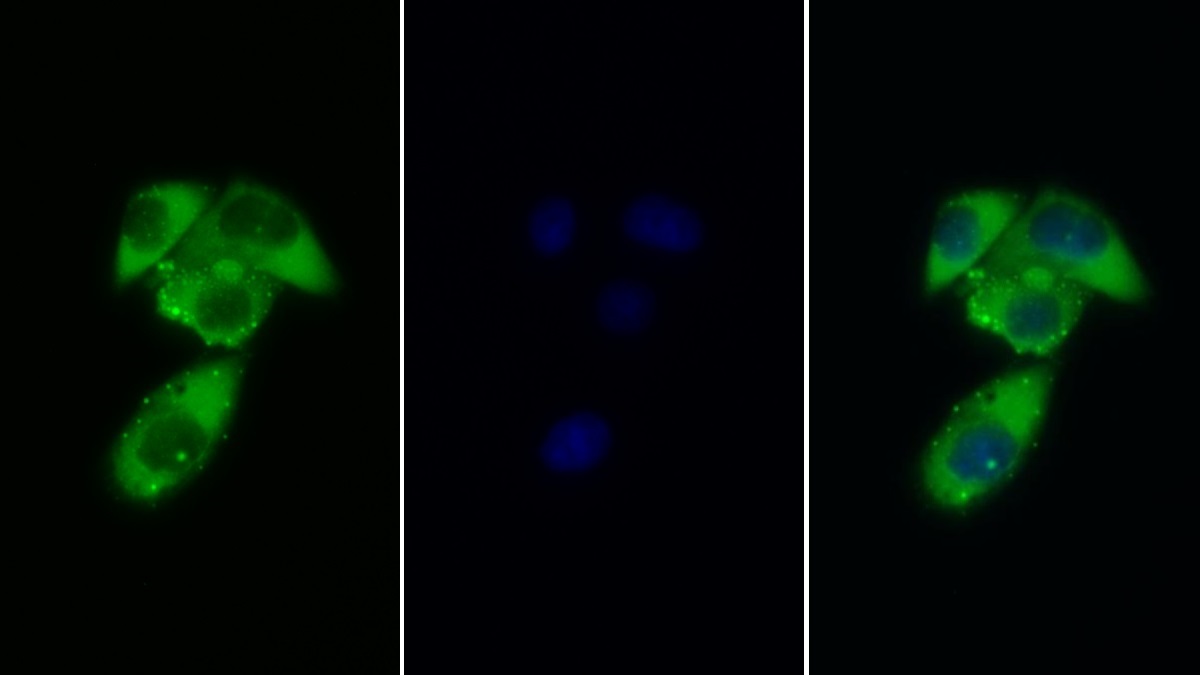 Polyclonal Antibody to Colony Stimulating Factor Receptor, Granulocyte (GCSFR)