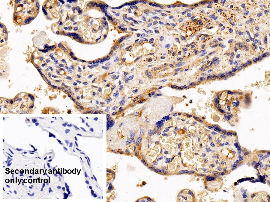 Polyclonal Antibody to Colony Stimulating Factor Receptor, Granulocyte (GCSFR)