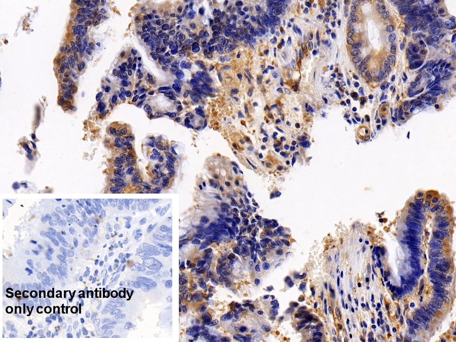 Polyclonal Antibody to Colony Stimulating Factor Receptor, Granulocyte (GCSFR)