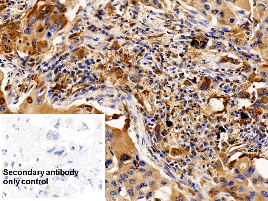 Polyclonal Antibody to Colony Stimulating Factor Receptor, Granulocyte (GCSFR)