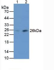 Polyclonal Antibody to Mannose Binding Lectin (MBL)