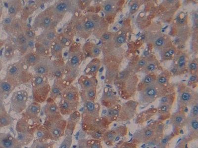 Polyclonal Antibody to Mannose Binding Lectin (MBL)