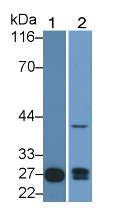 Polyclonal Antibody to Mannose Binding Lectin (MBL)