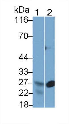 Polyclonal Antibody to Mannose Binding Lectin (MBL)