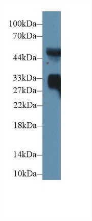 Polyclonal Antibody to Mannose Binding Lectin (MBL)