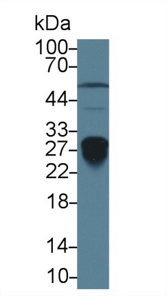 Polyclonal Antibody to Mannose Binding Lectin (MBL)