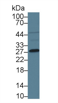 Polyclonal Antibody to Mannose Binding Lectin (MBL)