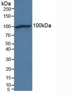 Polyclonal Antibody to N-cadherin (NCAD)