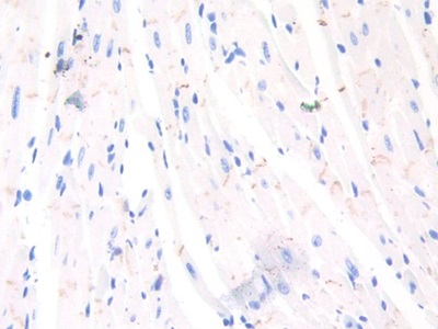 Polyclonal Antibody to N-cadherin (NCAD)