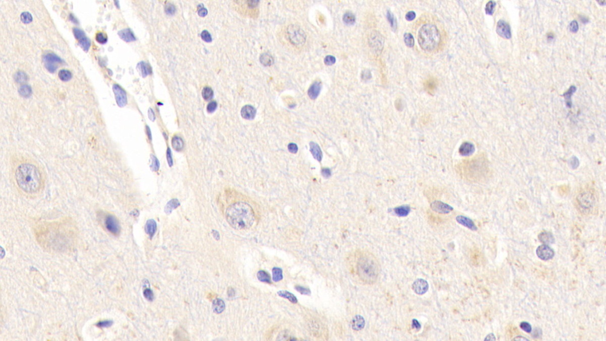 Polyclonal Antibody to Colony Stimulating Factor Receptor, Macrophage (MCSFR)