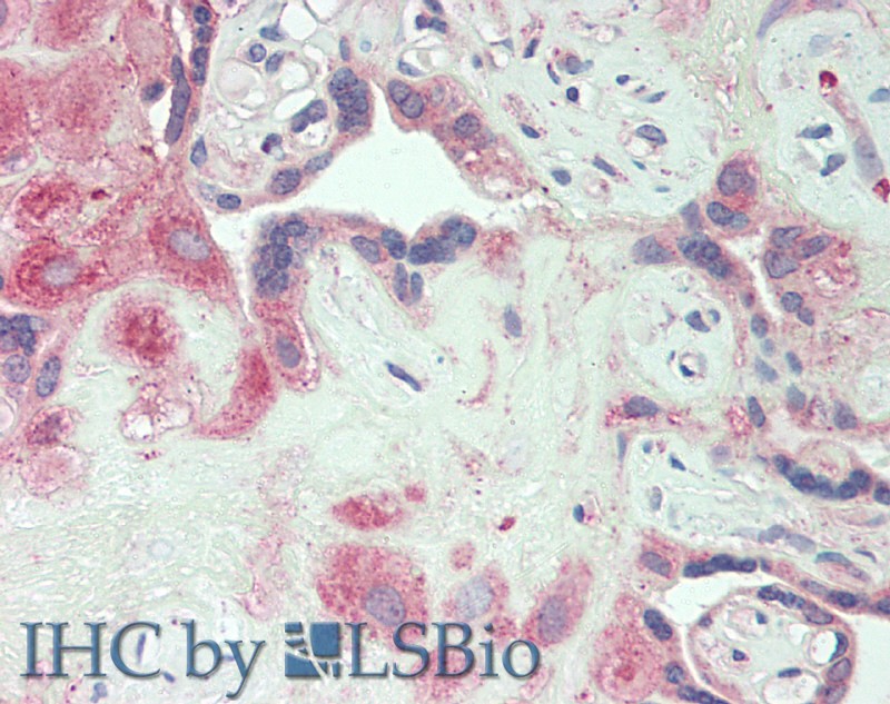 Polyclonal Antibody to Colony Stimulating Factor Receptor, Macrophage (MCSFR)