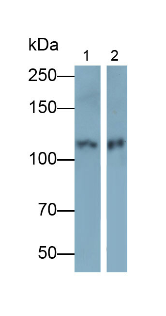 Polyclonal Antibody to Colony Stimulating Factor Receptor, Macrophage (MCSFR)