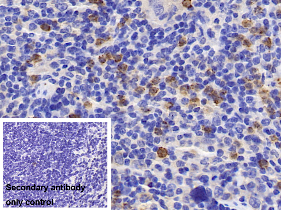 Polyclonal Antibody to Colony Stimulating Factor Receptor, Macrophage (MCSFR)