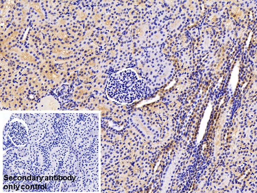 Polyclonal Antibody to Calreticulin (CALR)