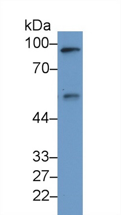 Polyclonal Antibody to Calreticulin (CALR)