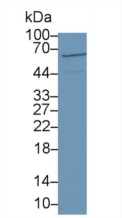 Polyclonal Antibody to Colony Stimulating Factor 2 Receptor Alpha (CSF2Ra)