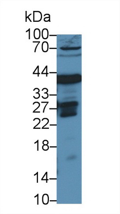 Polyclonal Antibody to Ornithine Transcarbamylase (OTC)