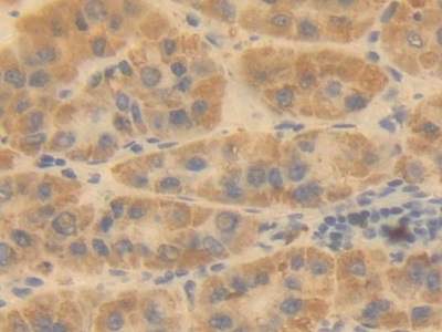 Polyclonal Antibody to Ornithine Transcarbamylase (OTC)