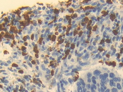 Polyclonal Antibody to Ornithine Transcarbamylase (OTC)