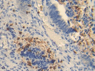 Polyclonal Antibody to Ornithine Transcarbamylase (OTC)