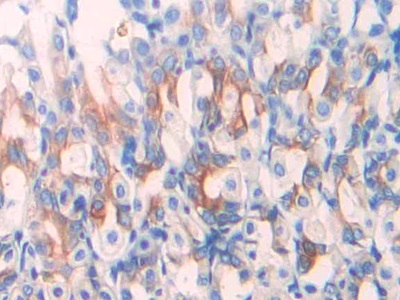 Polyclonal Antibody to Ornithine Transcarbamylase (OTC)