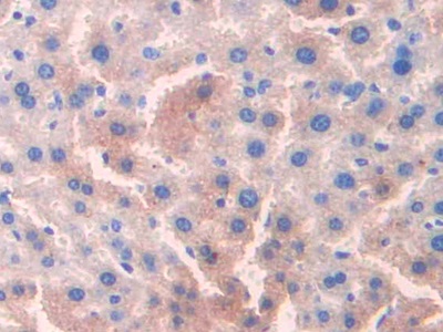 Polyclonal Antibody to Ornithine Transcarbamylase (OTC)