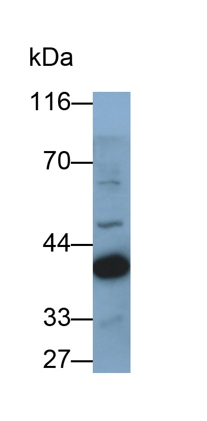 Polyclonal Antibody to Ornithine Transcarbamylase (OTC)